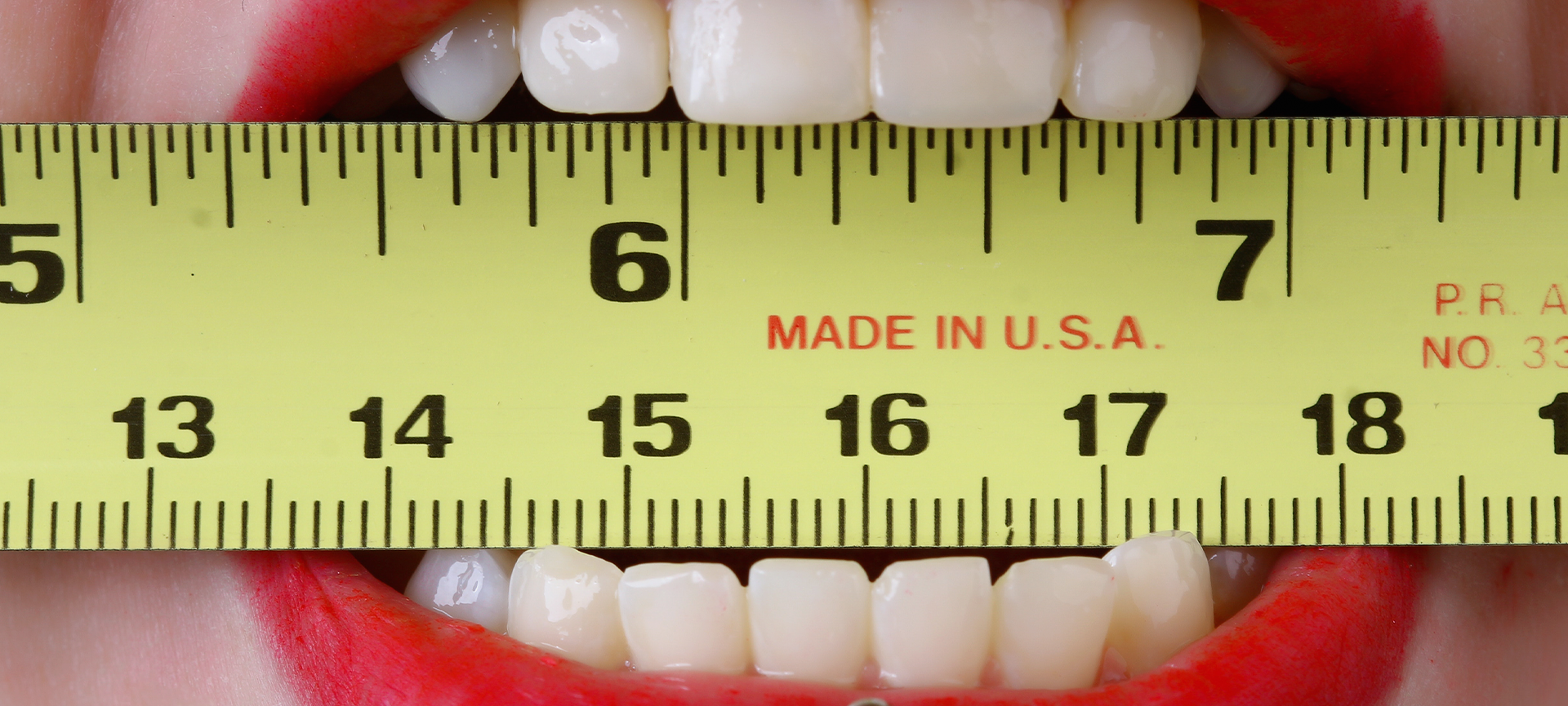 Depois da cirurgia íntima e da harmonização facial, a pressão estética chegou nos dentes!